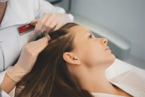  mesotherapy ผม